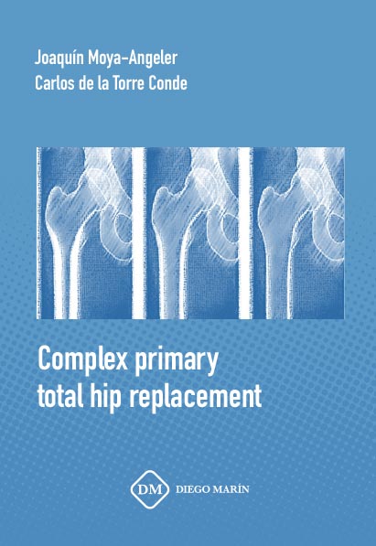COMPLEX PRIMARY TOTAL HIP REPLACEMENT